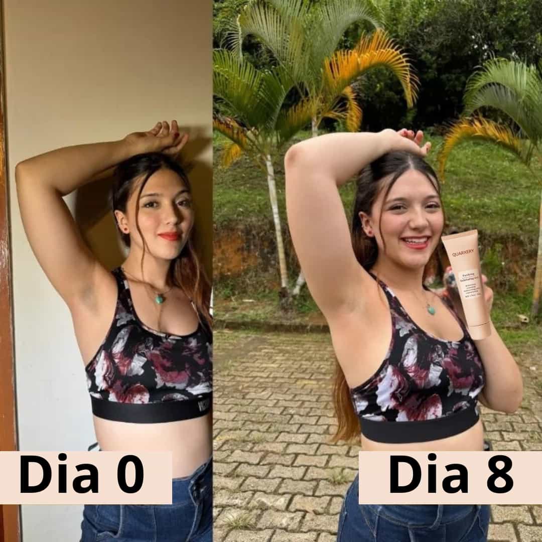 QUARXERY™  Gel Exfoliante – Promo 2 x 1 para una Piel Suave, Luminosa y uniforme.