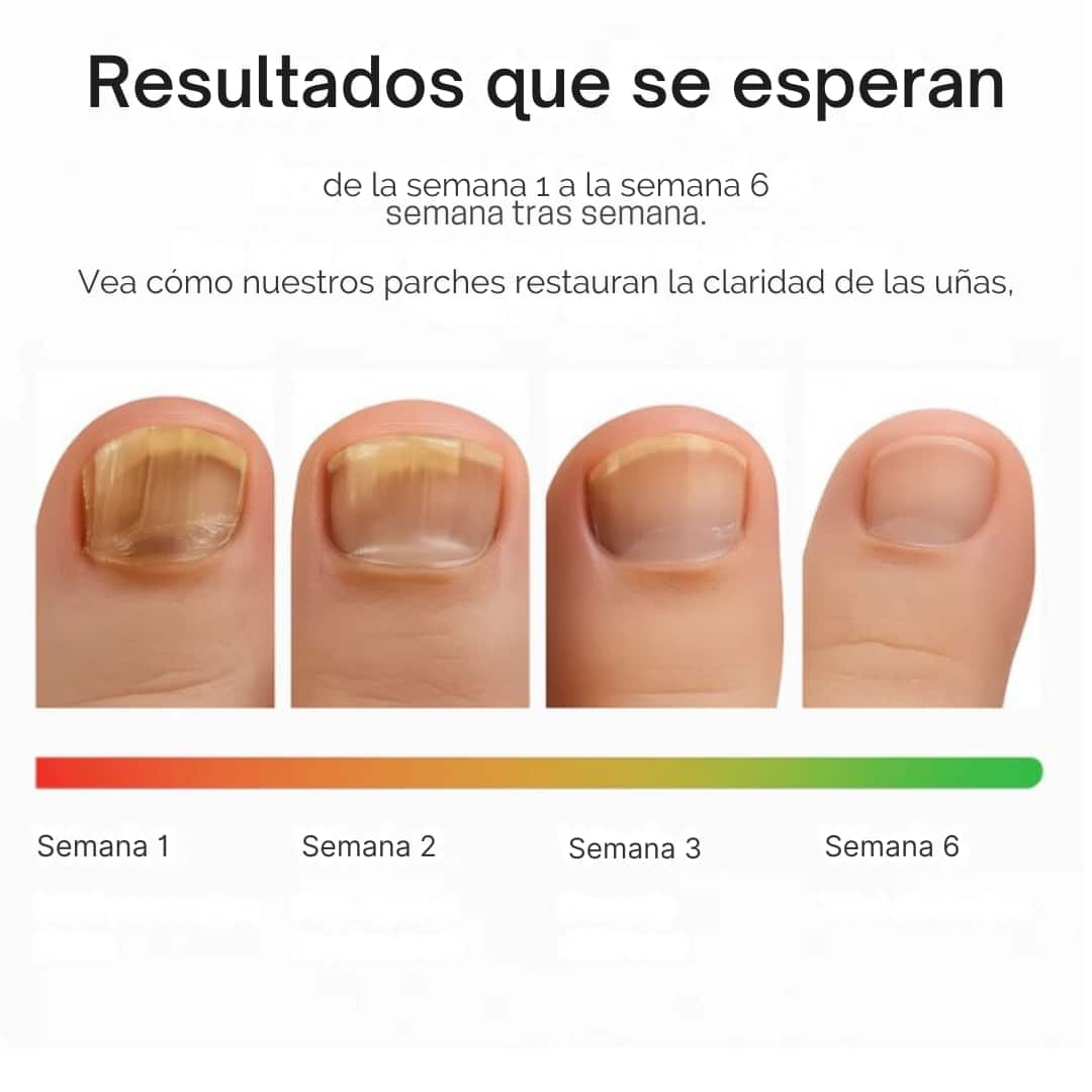SMART-NAILS®- Parches Restauradores de uñas