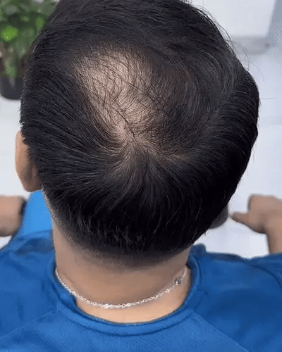 BUNEE™️PROMO 2 X 1 - Cubre zonas despobladas y canas al instante. - HOUSE SHOP