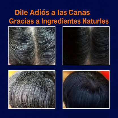 KID CHAO CANAS + TRATAMENTIENTO - Dile adiós a las canas y revitaliza tu cabello en minutos
